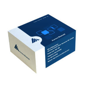 Kit di test per malattie infettive - Aurora Instruments - del vaiolo delle scimmie / di siero / per immunoistochimica