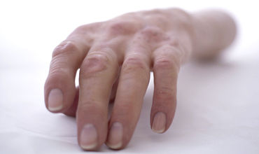Protesi estetica per braccio - Protunix - per adulti