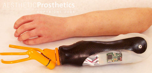 Protesi di mano mioelettrica - Aesthetic Prosthetics - uncino/pinza / per adulti
