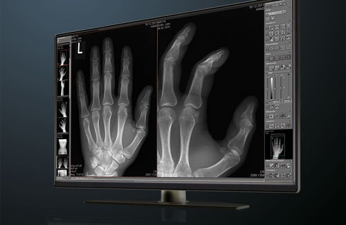 Software di gestione - dicomPACS® Basic - OR Technology - Oehm und Rehbein - per diagnostica per immagini / MRI