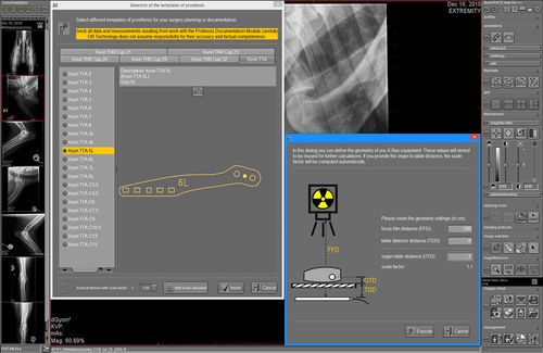 Modulo software di pianificazione - dicomPACS® vet Prosthesis  - OR Technology - Oehm und Rehbein - per chirurgia ortopedica / veterinario
