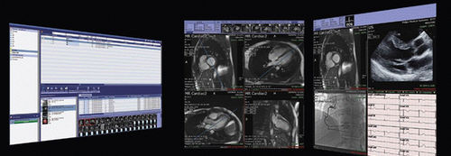 Software clinico - iNteract™ + ¡Review - TeraRecon - per diagnostica per immagini / di condivisione / diagnostico