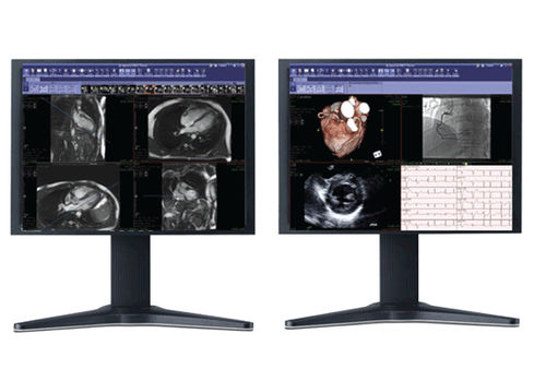 Software di oncologia - iNtuition REVIEW - TeraRecon - cardiovascolare / per diagnostica per immagini / di visualizzazione 3D