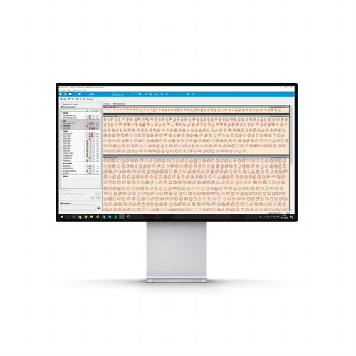 Applicazione web di analisi delle immagini - Cellavision AB - di visualizzazione / diagnostica / medica