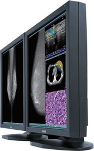 Monitor medico - CCL550i2 - TOTOKU - per mammografia / 21.3" / LCD