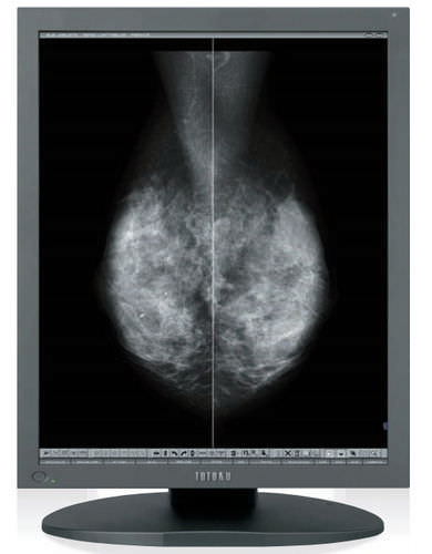 Monitor medico - MS55i2 - TOTOKU - per mammografia / ad alta definizione / LCD