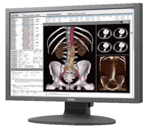 Monitor per diagnostica per immagini - CCL242 - TOTOKU - 24" / LCD / con retroilluminazione LED