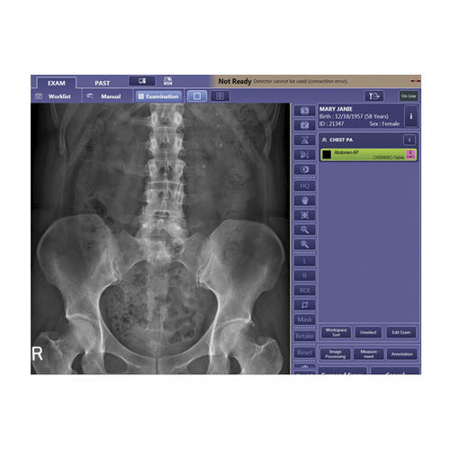 Software di analisi delle immagini - CXDI  - Canon Medical System U.S.A - di controllo / di visualizzazione / di acquisizione