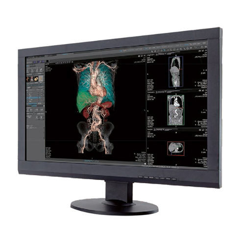 Workstation per diagnostica per immagini - Canon Medical System U.S.A