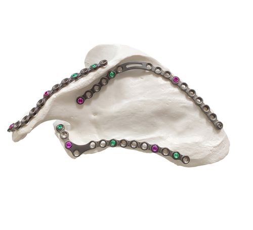 Placca di compressione di scapola - HJ-Scapula - Health-Joy Medical - laterale / mediale / bloccata