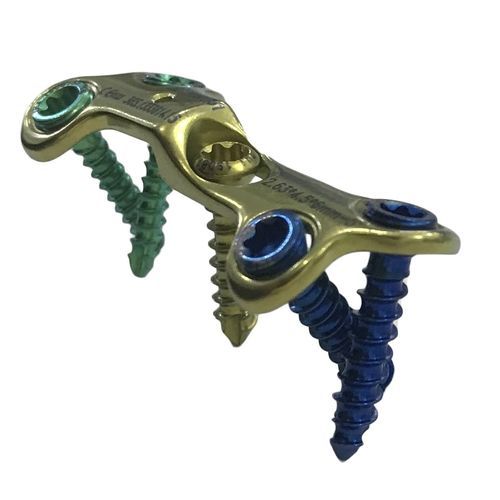Placca per osteotomia per metatarso - HJ-VA-LOC 03 - Health-Joy Medical - per avampiede / mediale / bloccata