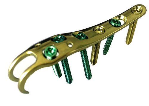 Placca di compressione per metatarso - HJ-Foot VA-LOC 09 - Health-Joy Medical - distale / laterale / bloccata