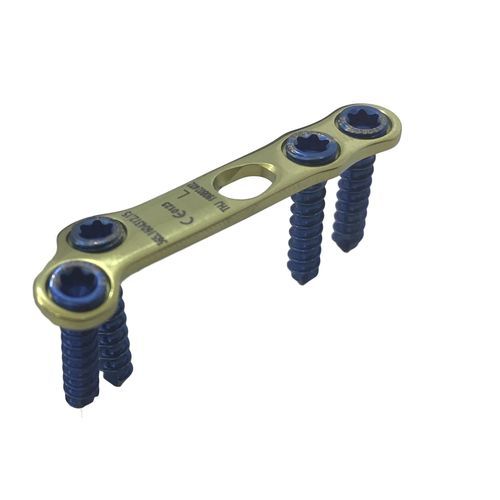 Placca per artrodesi per articolazione metatarso-falangea - HJ-VA-LOC15 - Health-Joy Medical - per articolazione tarso-metatarsica / per metatarso / bloccata