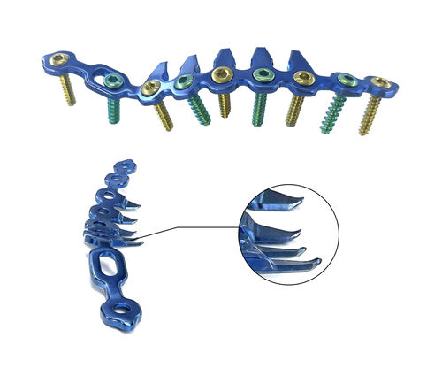 Placca di compressione per bacino - HJ-06 - Health-Joy Medical - posterolaterale / posteromediale / non bloccata