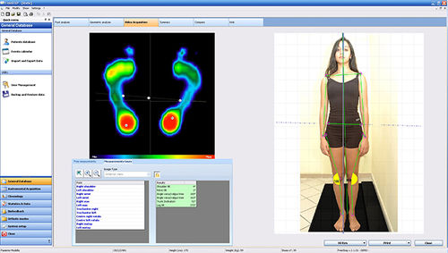Software di analisi - Sensor Medica - per podologia