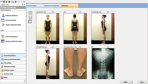 Software di analisi - Sensor Medica - di misura / di posturologia