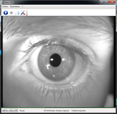 Software di registrazione video - FRAMVIDEO - Framiral - medico / di registrazione video