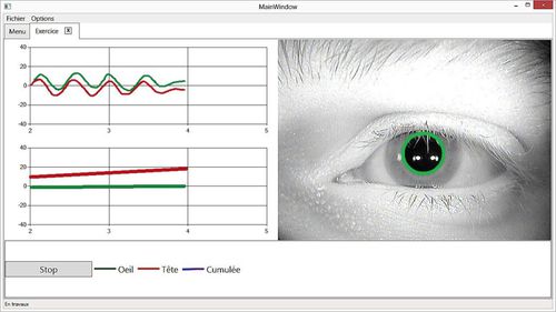 Software di acquisizione - Framiral - medico / di occhio / di testa
