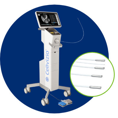 Sistema di imaging endoscopico CLE - CELLVIZIO®  - Mauna Kea Technologies - broncoscopia