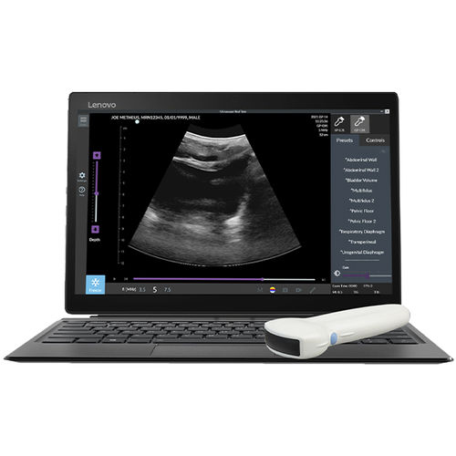 Ecografo portatile - (TUI-S-T) Pathway® US  - The Prometheus Group - per ecografia addomino-pelvica / in bianco e nero / con doppler a colori