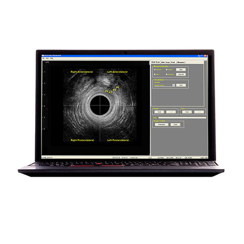 Ecografo portatile - (RTCU-S-N) Morpheus® 360° Endocavity US  - The Prometheus Group - per ecografia ginecologica ed ostetrica / per ecografia colorettale / in bianco e nero