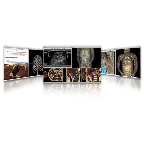 Software didattico - VH Dissector - Touch of Life Technologies (ToLTech) - di anatomia