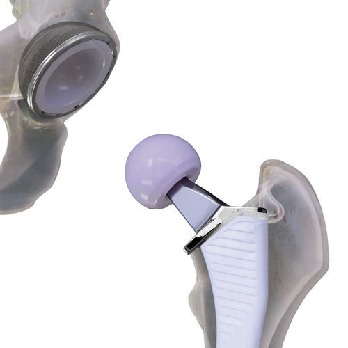Protesi di anca di prima intenzione - Cordera™  - ConforMIS - non cementata