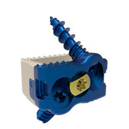 Gabbia intersomatica cervicale - Dakota ACDF™ - Precision Spine - via anteriore / in titanio / in PEEK
