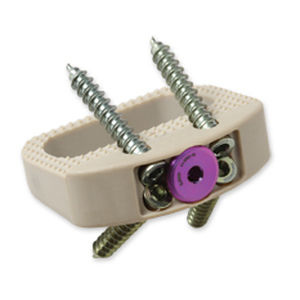 Gabbia intersomatica lombare - Vault® - Precision Spine - via anteriore / in PEEK