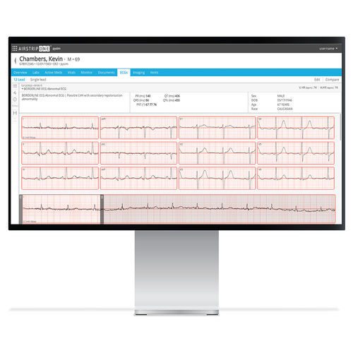 Software di gestione - AirStrip Technologies - di trattamento / di interpretazione / medico
