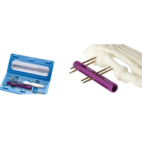 Fissatore esterno per tarso - SIDEKICK™ - Wright Medical Technology - tubolare / per adulti