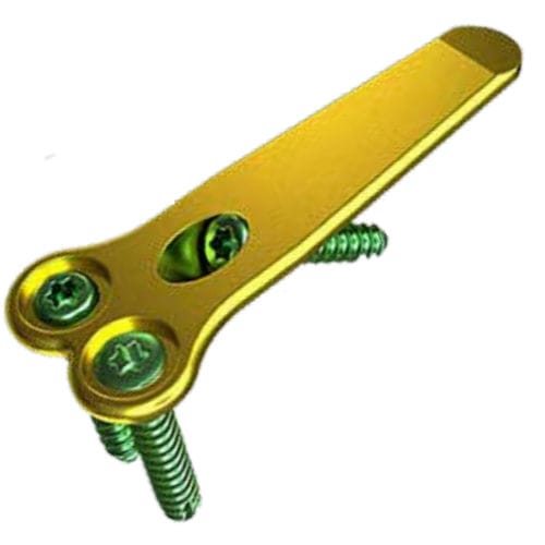 Placca per artrodesi per alluce valgo - MAXLOCK™ EXTREME™ - Wright Medical Technology - distale / prossimale / bloccata