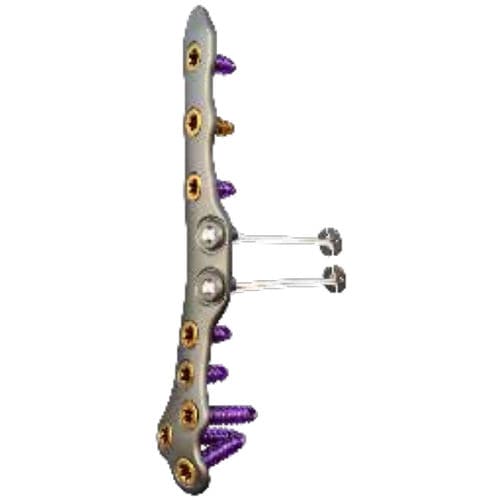 Placca di compressione per tibia - ORTHOLOC™ 2 - Wright Medical Technology - per fibula / per caviglia / prossimale