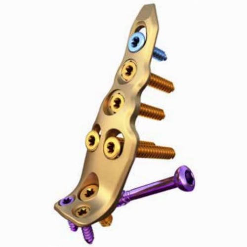 Placca di compressione per fibula - ORTHOLOC™ - Wright Medical Technology - distale / bloccata / non bloccata