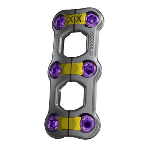 Placca per artrodesi cervicale - Trestle Luxe™ - Alphatec Spine - bloccata / 2 livelli