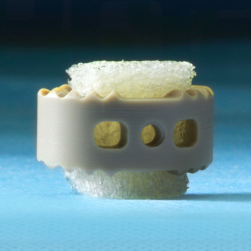 Sostituto osseo allotrapianto - 3D Profuse® - Alphatec Spine - per chirurgia ortopedica / conformabile