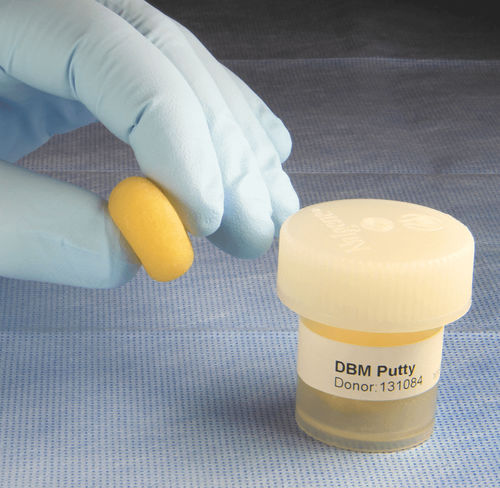 Sostituto osseo allotrapianto - AlphaGRAFT®  - Alphatec Spine - per chirurgia ortopedica / conformabile