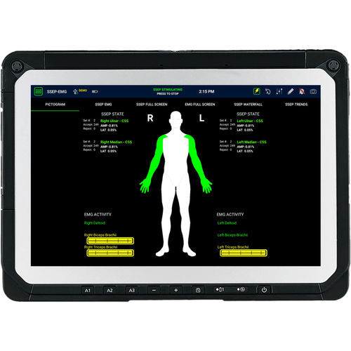 Sistema informativo di monitoraggio - SafeOp™ - Alphatec Spine - per neurochirurgia / ortodontico