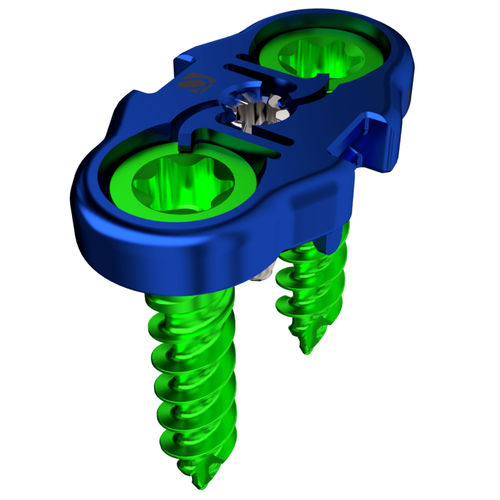 Placca per artrodesi per vertebra lombare - AMP™ - Alphatec Spine - laterale / bloccata