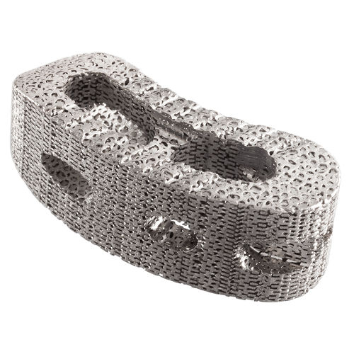 Gabbia intersomatica toraco-lombare - IdentiTi™-PC - Alphatec Spine - via posteriore / in titanio