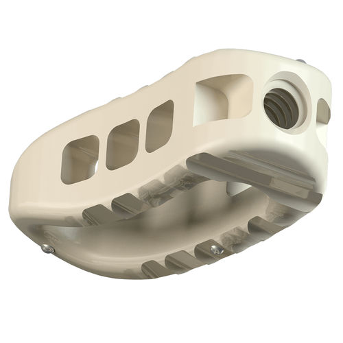 Gabbia intersomatica lombare - Novel® Tapered TL - Alphatec Spine - via transforaminale