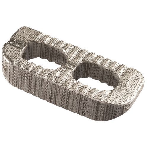 Gabbia intersomatica toracica - IdentiTi™ LIF - Alphatec Spine - via laterale / in titanio