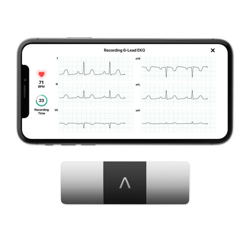 Monitor paziente portatile - KardiaMobile® 6L - AliveCor - ECG / per cure domiciliari / per esterni