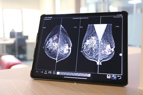 Applicazione web medica - UDE - EBM Technologies - per diagnostica per immagini / per DICOM / di condivisione