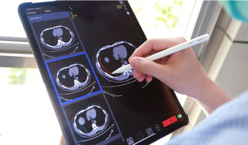 Applicazione iOS medica - XAnnotation - EBM Technologies - didattica / d’importazione / cloud