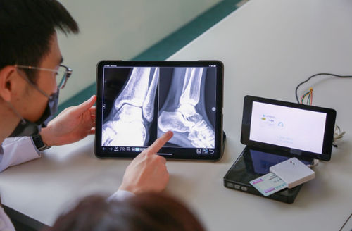 Applicazione iOS medica - EXCD - EBM Technologies - per PACS / visualizzatore / server
