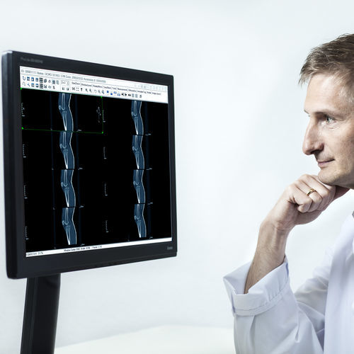 PACS per diagnostica per immagini - SoliPACS™ - EBM Technologies
