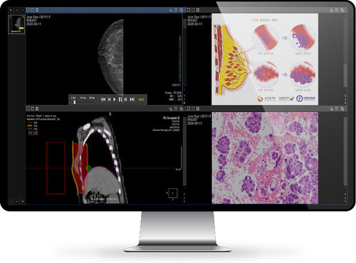 Software di gestione - INFINITT North America - di condivisione / clinico / per diagnostica per immagini