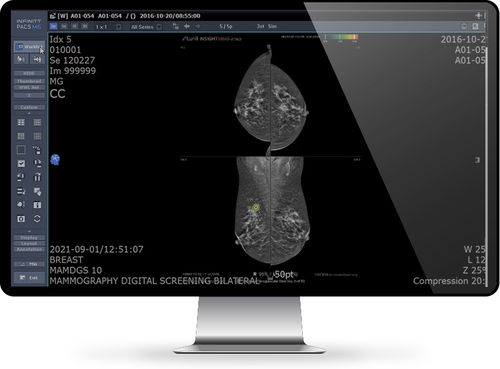 PACS per diagnostica per immagini - INFINITT North America