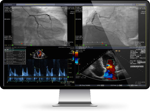 PACS per diagnostica per immagini - INFINITT North America - basato sul web